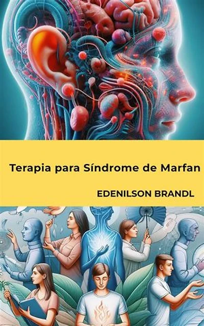 Terapia para Síndrome de Marfan