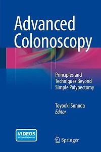 Advanced Colonoscopy: Principles And Techniques Beyond Simple Polypectomy