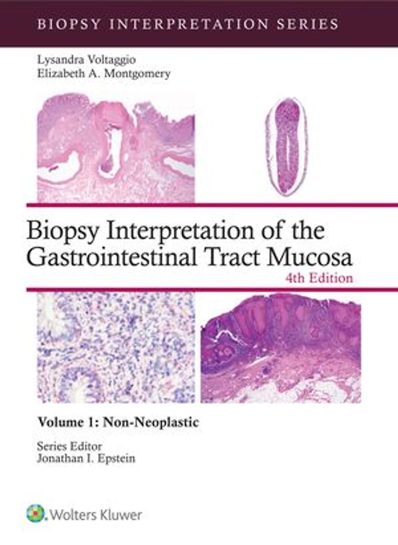 Biopsy Interpretation of the Gastrointestinal Tract Mucosa Volume 1: Non-Neoplastic: Print + eBook with Multimedia