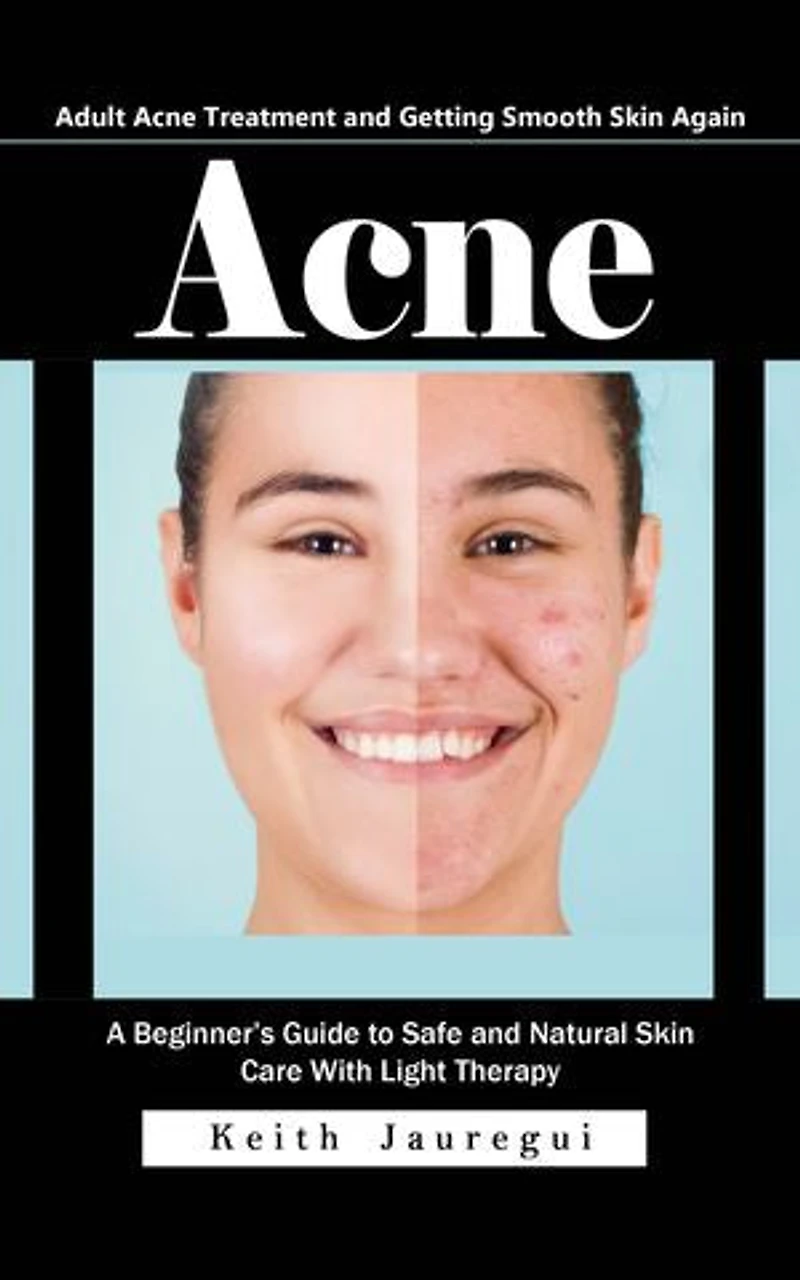 Acne: Adult Acne Treatment and Getting Smooth Skin Again (A Beginner’s Guide to Safe and Natural Skin Care With Light Therapy)
