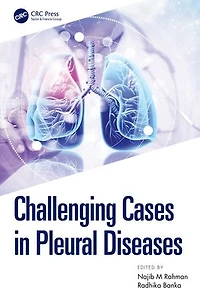 Challenging Cases Pleural Diseases