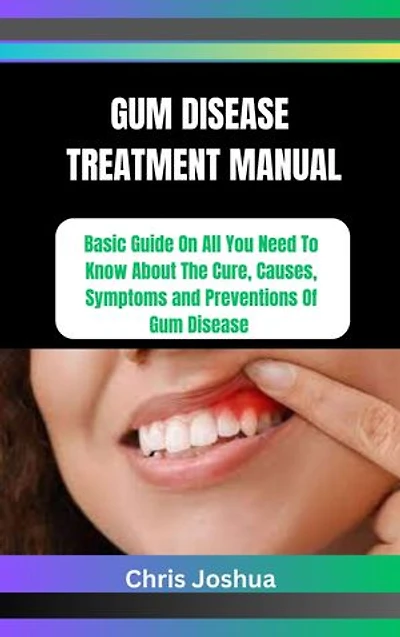GUM DISEASE TREATMENT MANUAL: Basic Guide On All You Need To Know About The Cure, Causes, Symptoms and Preventions Of Gum Disease