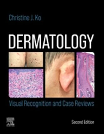 Dermatology: Visual Recognition And Case Reviews
