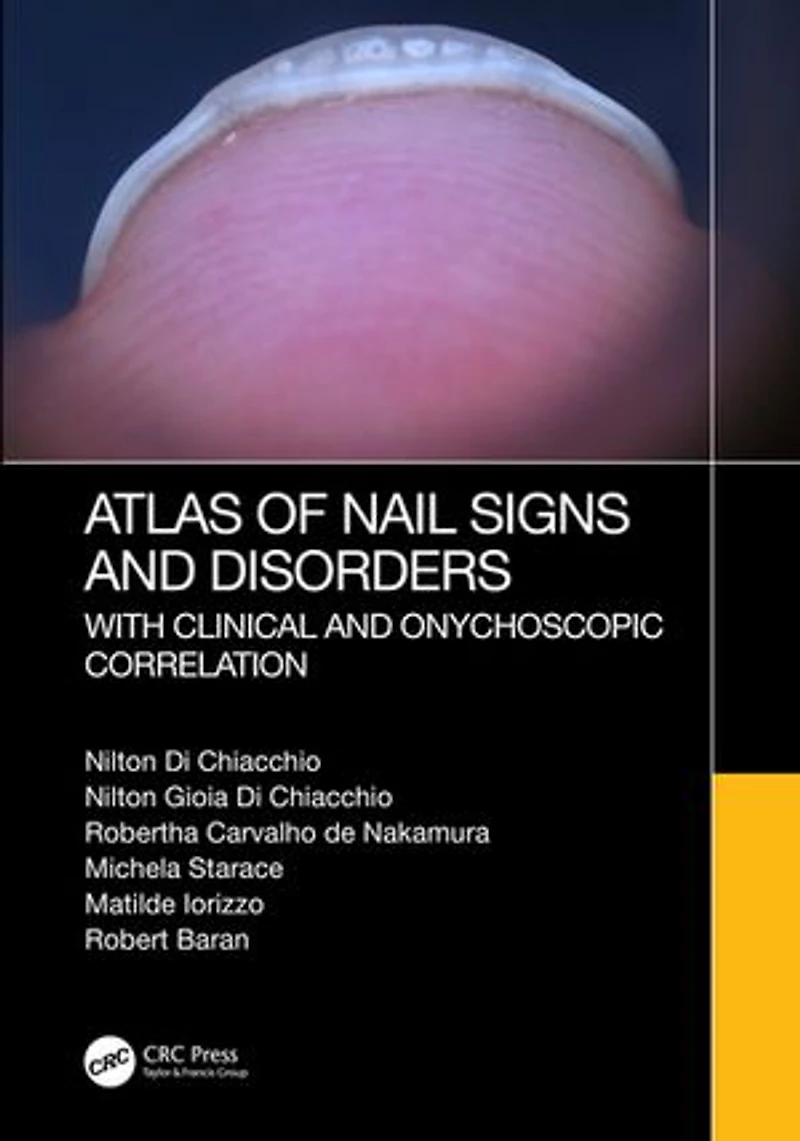 Atlas of Nail Signs and Disorders with Clinical Onychoscopic Correlation