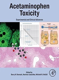 Acetaminophen Toxicity: Experimental and Clinical Advances