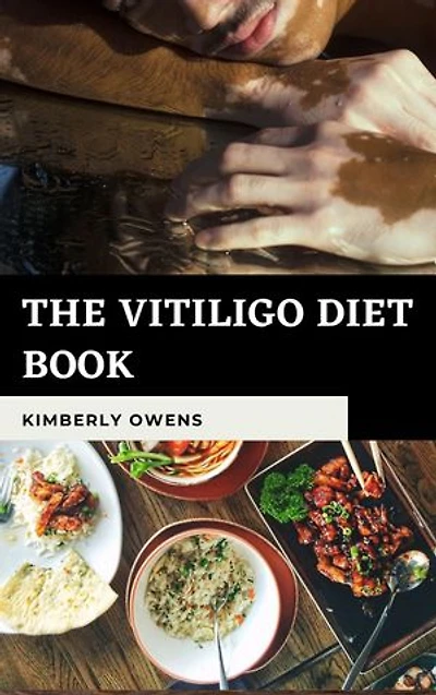 The Vitiligo Diet Book: Complete Ultimate Recipe to Treat Vitiligo With Diet Without Using Pharmaceutical Drugs
