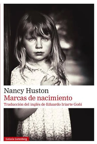 Marcas de nacimiento
