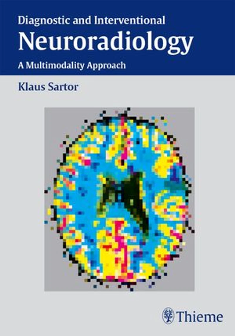 Diagnostic and Interventional Neuroradiology: A Multimodality Approach