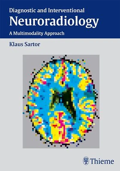 Diagnostic and Interventional Neuroradiology: A Multimodality Approach