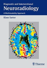 Diagnostic and Interventional Neuroradiology: A Multimodality Approach