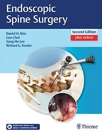 Endoscopic Spine Surgery