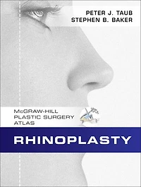 Rhinoplasty: McGraw-Hill Plastic Surgery Atlas