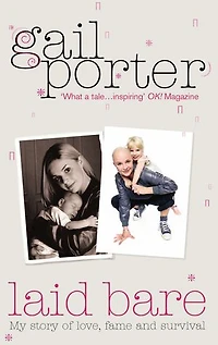 Laid Bare: My story of love, fame and survival