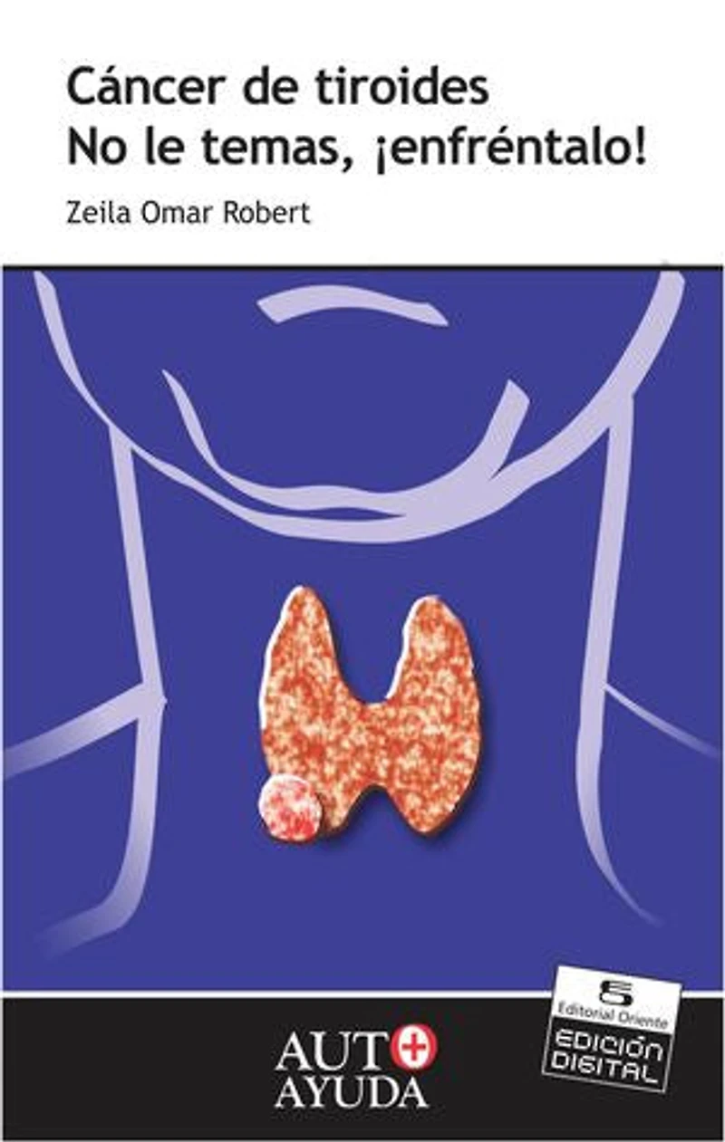 Cáncer de tiroides: No le temas, ¡enfréntalo!