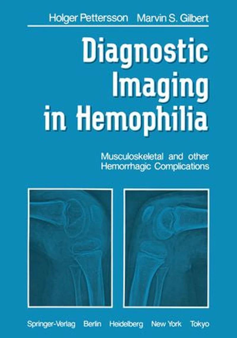 Diagnostic Imaging Hemophilia: Musculoskeletal and Other Hemorrhagic Complications