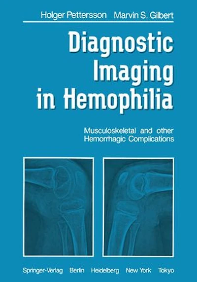 Diagnostic Imaging Hemophilia: Musculoskeletal and Other Hemorrhagic Complications