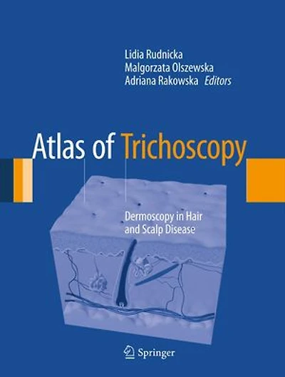 Atlas of Trichoscopy: Dermoscopy Hair and Scalp Disease