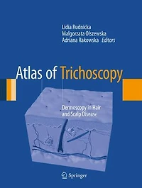 Atlas of Trichoscopy: Dermoscopy Hair and Scalp Disease