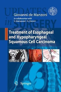 Treatment of Esophageal and Hypopharingeal Squamous Cell Carcinoma