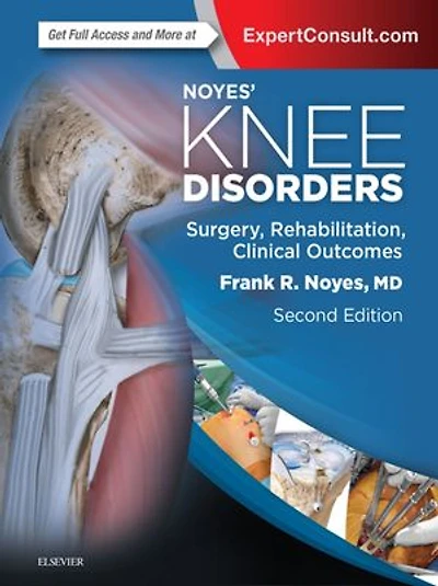 Noyes' Knee Disorders: Surgery, Rehabilitation, Clinical Outcomes E-Book