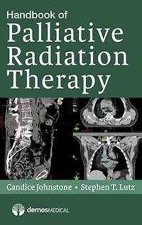 Handbook of Palliative Radiation Therapy