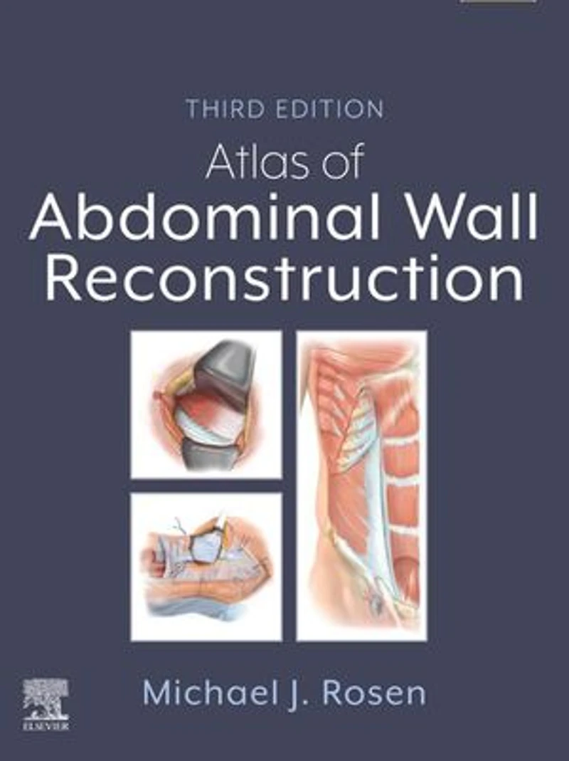 Atlas of Abdominal Wall Reconstruction