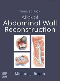 Atlas of Abdominal Wall Reconstruction