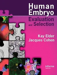 Human Preimplantation Embryo Selection