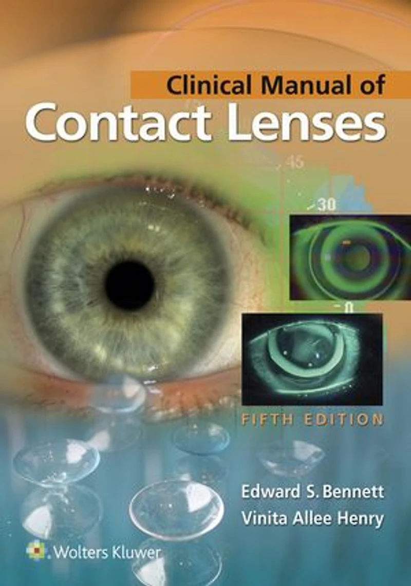 Clinical Manual Of Contact Lenses