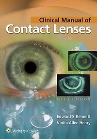 Clinical Manual Of Contact Lenses
