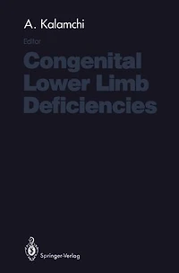 Congenital Lower Limb Deficiencies