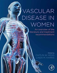 Vascular Disease in Women: An Overview of the Literature and Treatment Recommendations