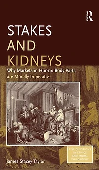 Stakes And Kidneys: Why Markets Human Body Parts Are Morally Imperative