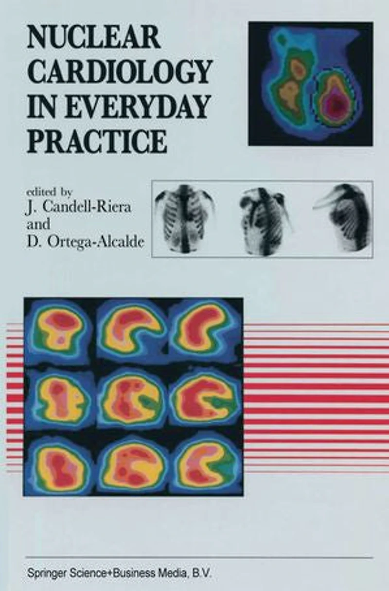 Nuclear Cardiology Everyday Practice