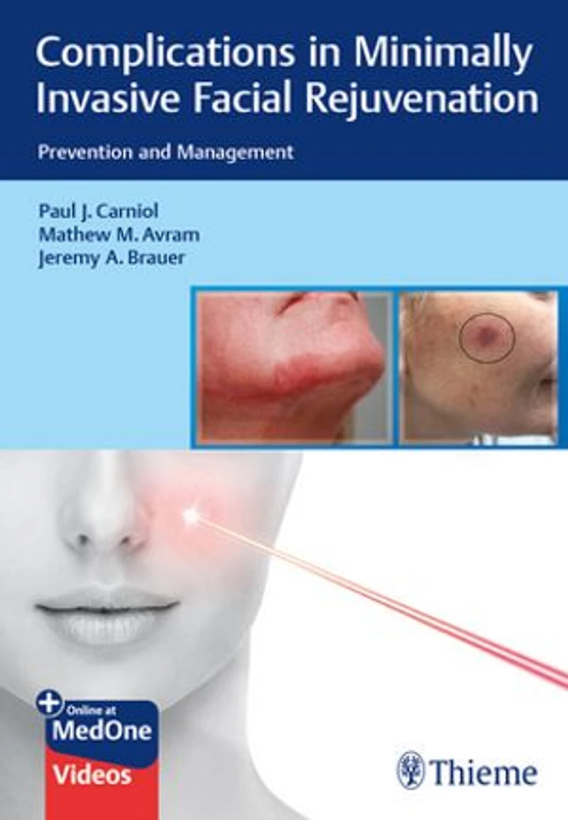 Complications Minimally Invasive Facial Rejuvenation: Prevention And Management