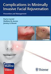 Complications Minimally Invasive Facial Rejuvenation: Prevention And Management