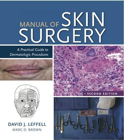 Manual of Skin Surgery: A Practical Guide to Dermatologic Procedures