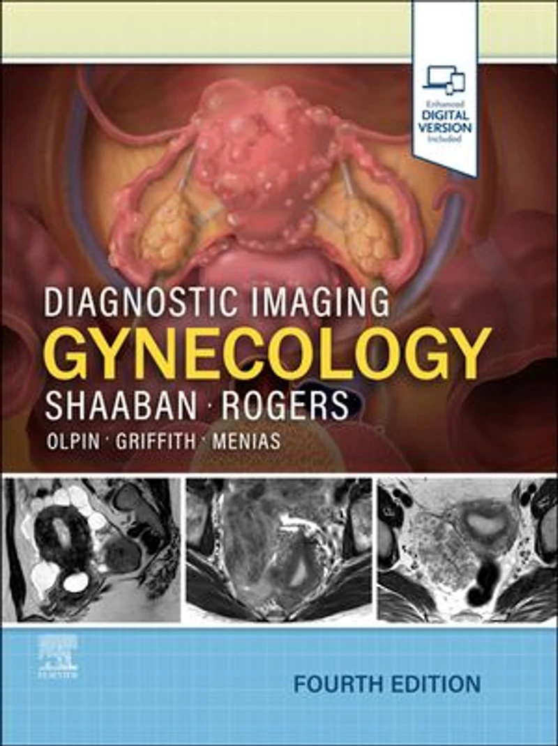 Diagnostic Imaging: Gynecology