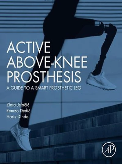 Active Above-Knee Prosthesis: a Guide to Smart Prosthetic Leg