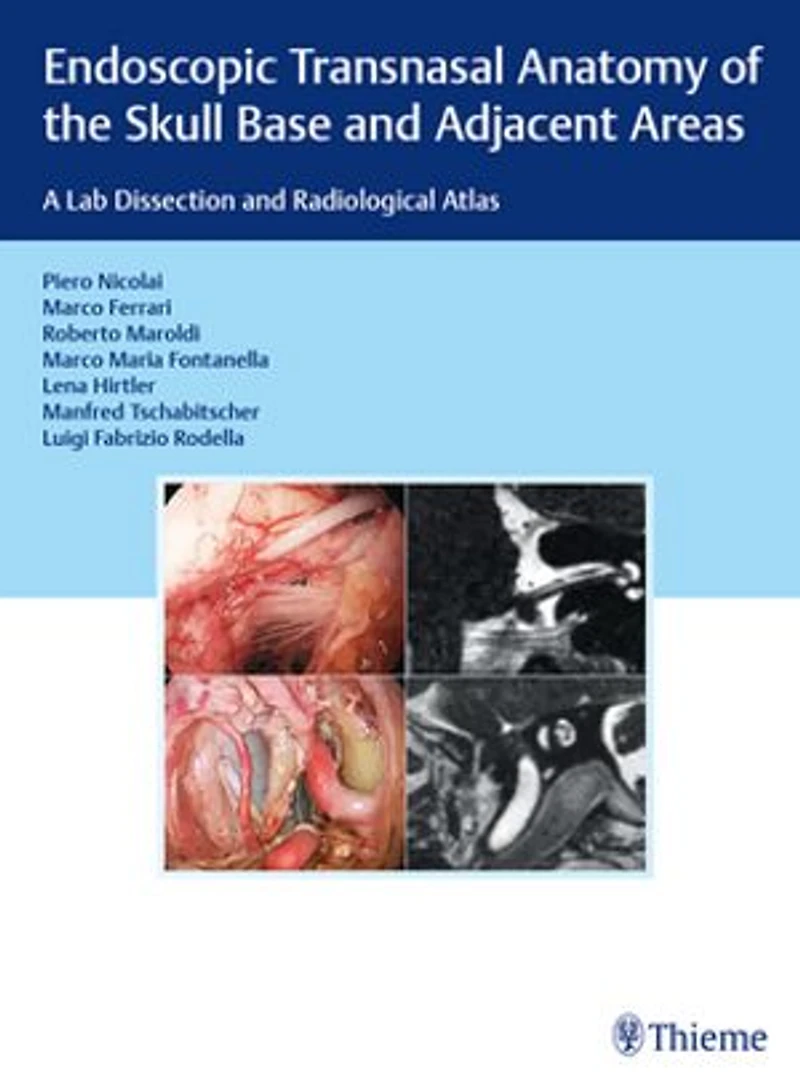 Endoscopic Transnasal Anatomy Of The Skull Base And Adjacent Areas: A Lab Dissection Radiological Atlas