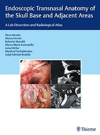 Endoscopic Transnasal Anatomy Of The Skull Base And Adjacent Areas: A Lab Dissection Radiological Atlas