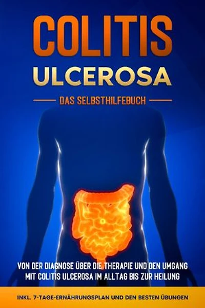 Colitis ulcerosa - Das Selbsthilfebuch: Von der Diagnose über die Therapie und den Umgang mit Colitis ulcerosa im Alltag bis zur Heilung - inkl. 7-Tage-Ernährungsplan und den besten Übungen
