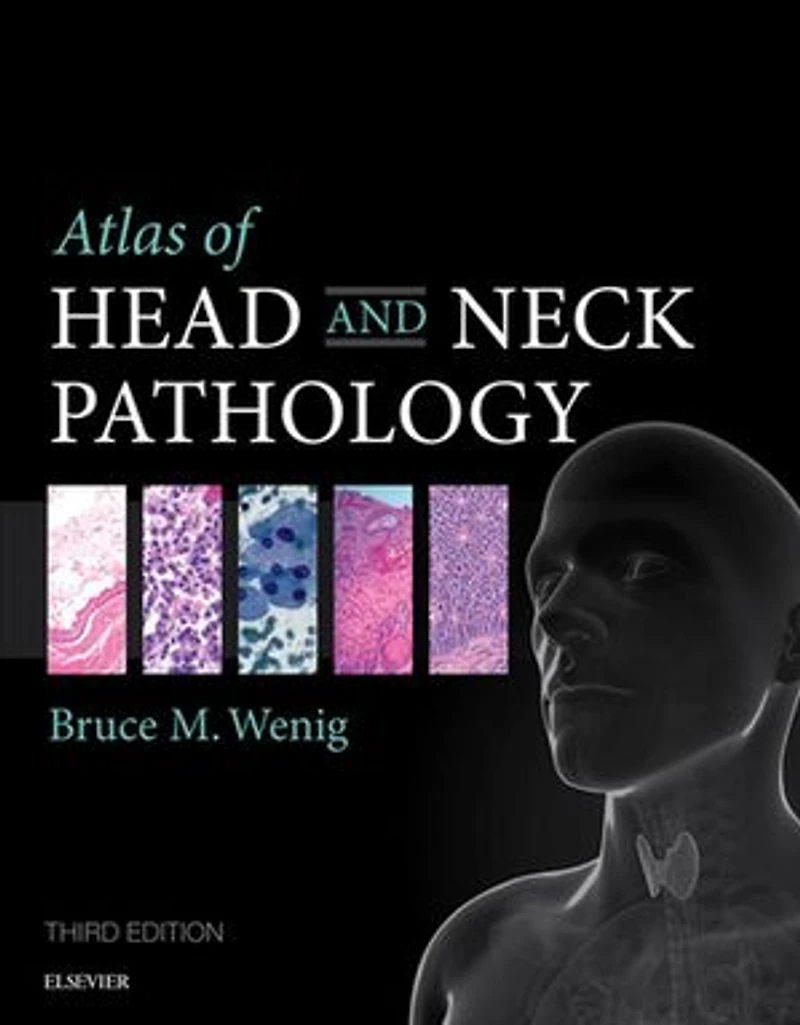 Atlas Of Head And Neck Pathology