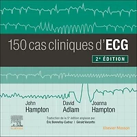 150 cas cliniques d'ECG