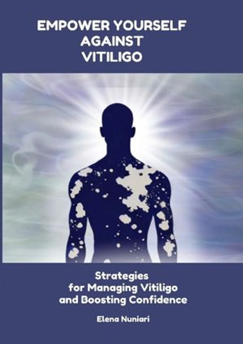 Empower Yourself Against Vitiligo: Strategies for Managing Vitiligo and Boosting Confidence