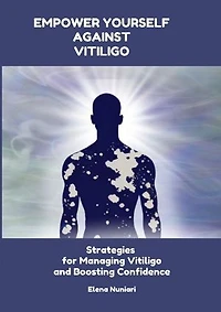 Empower Yourself Against Vitiligo: Strategies for Managing Vitiligo and Boosting Confidence