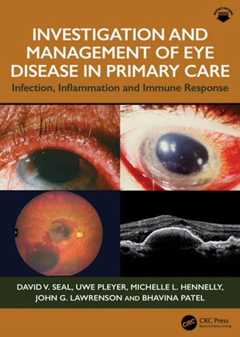 Investigation and Management of Eye Disease Primary Care: Infection, Inflammation Immune Response