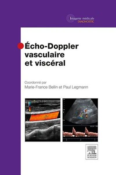 Echo-Doppler vasculaire et viscéral