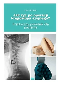 Jak żyć po operacji kręgosłupa szyjnego?: Praktyczny poradnik dla pacjenta