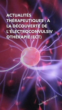 Actualités Thérapeutiques : A la Découverte de L'électroconvulsivothérapie (ECT): Engineering | Administration | Management | Research | Education | Apprenticeship | Project